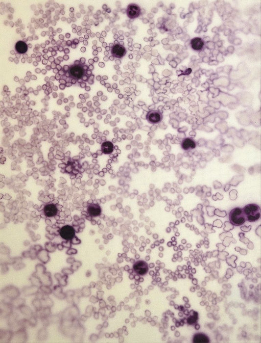 Leukocytes Composition no. 114