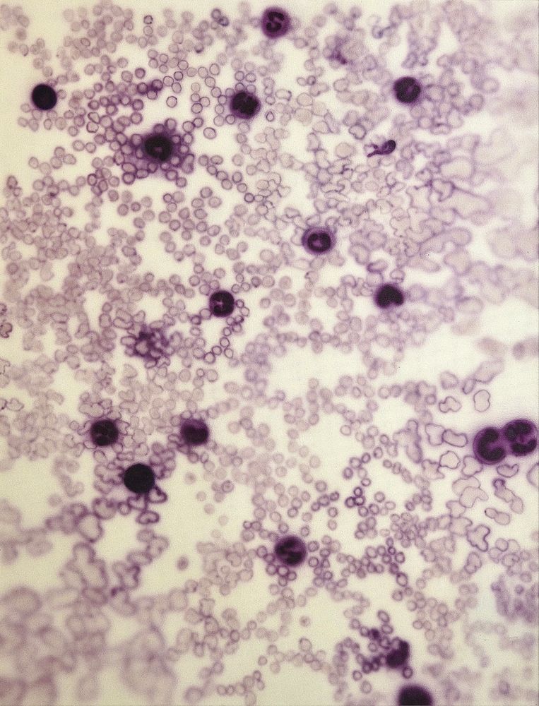 Leukocytes Composition no. 114