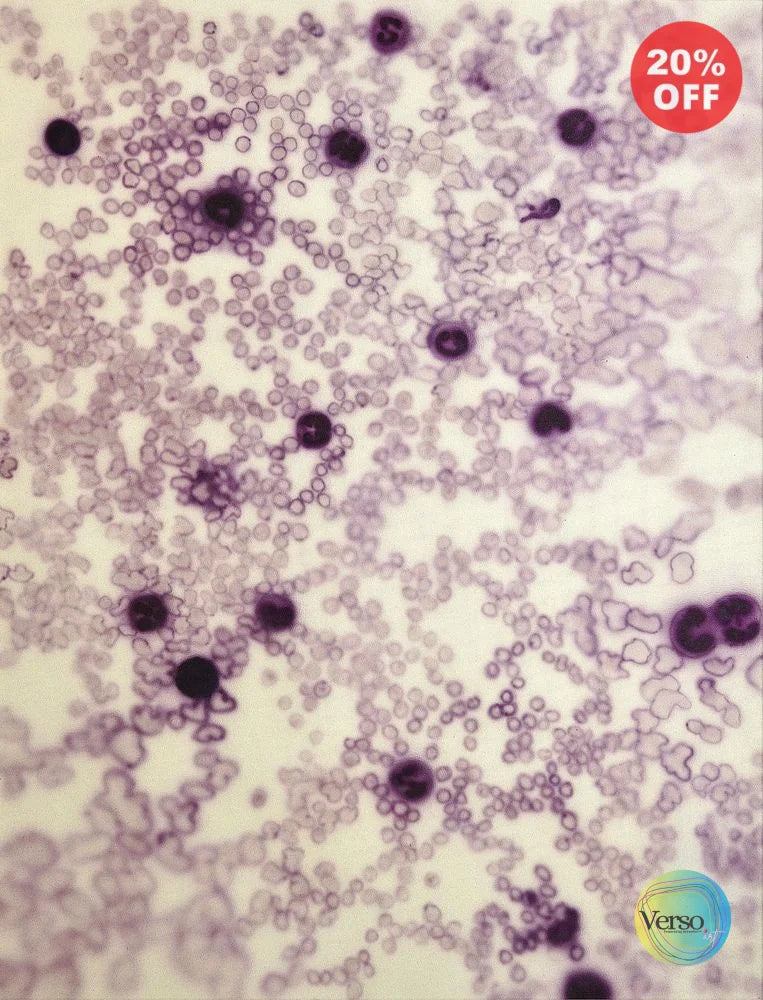 Leukocytes Composition no. 114 - 100 x 130 cm / Acrylic / Unframed, shipped in a roll