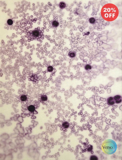 Leukocytes Composition no. 114 - 100 x 130 cm / Acrylic / Unframed, shipped in a roll
